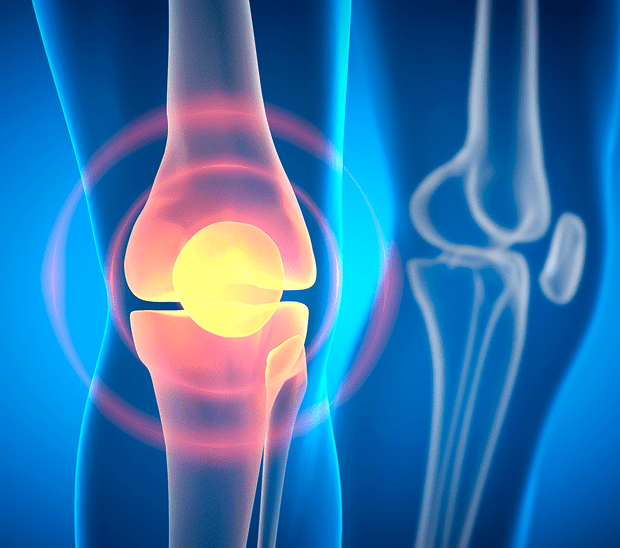 Illustration of knee joint with highlighted pain.